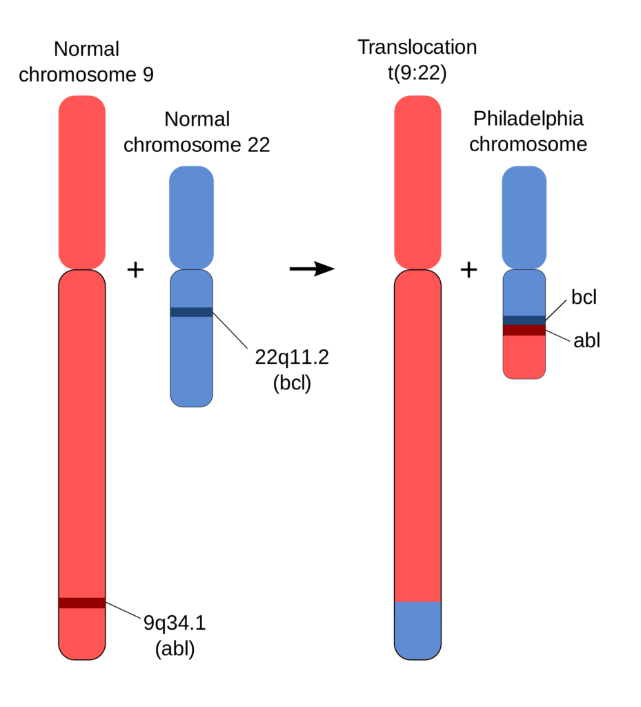 The Philadelphia chromosome contains the BCR-ABL gene fusion