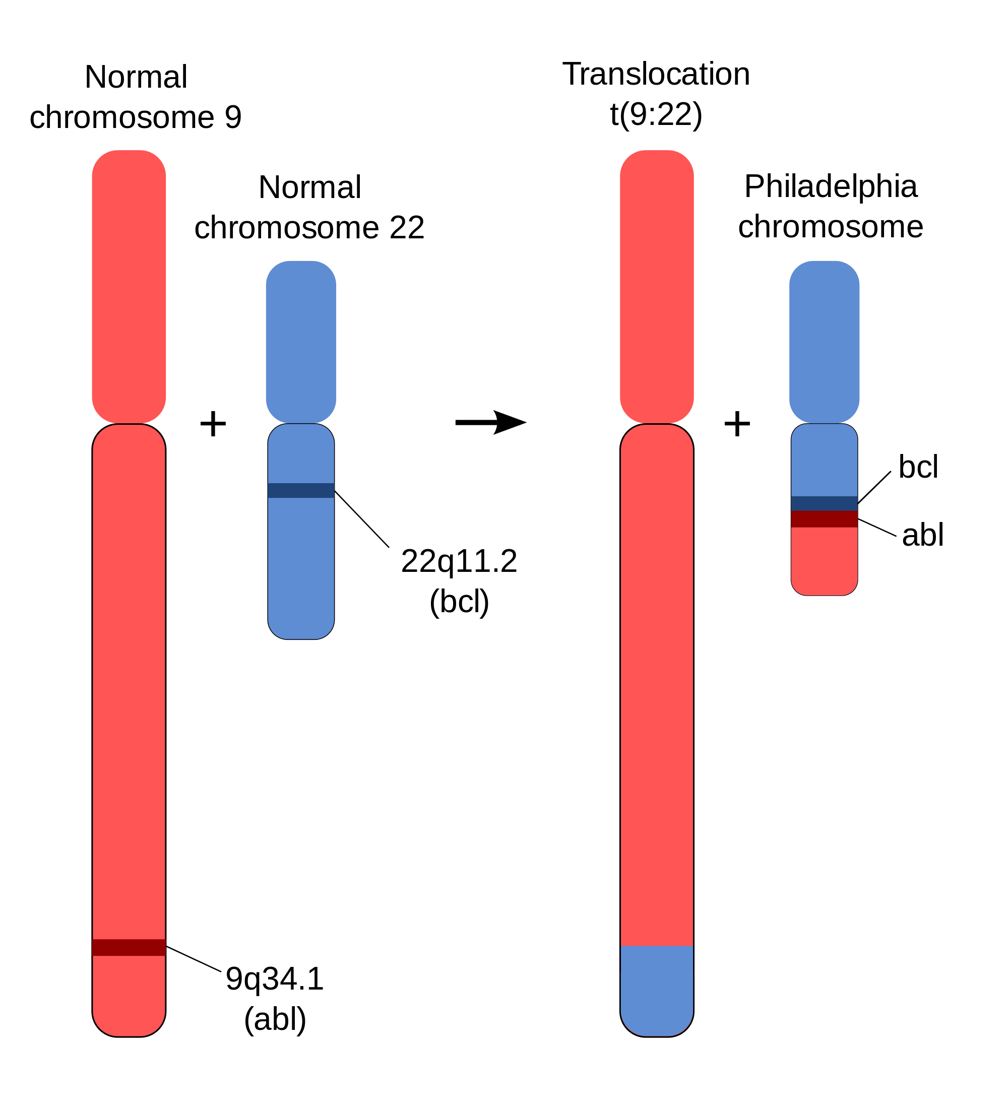 bcr abl gene - transcrit bcr abl